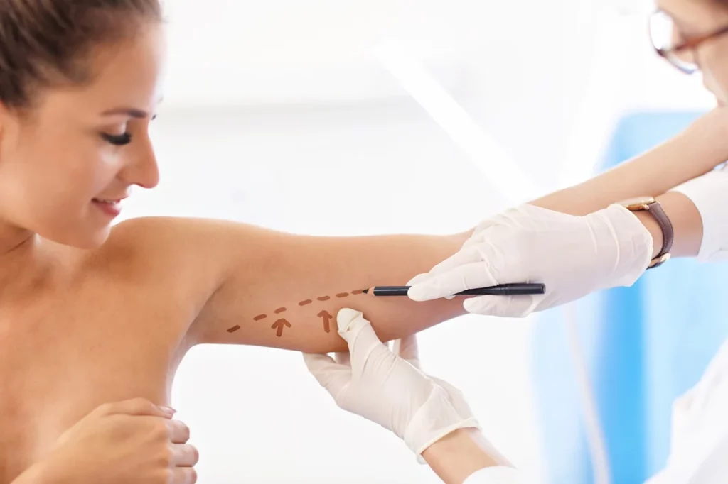 Arm lift in Kerrville and Houston, TX | Layton Aesthetic plastic surgery