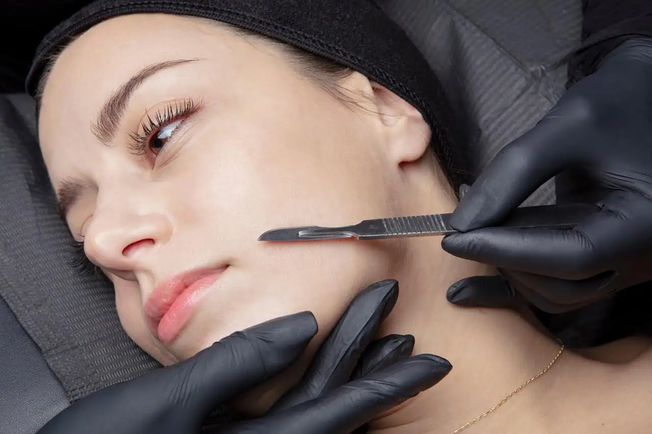 Dermaplaning in Kerrville and Houston, TX | Layton Aesthetic plastic surgery