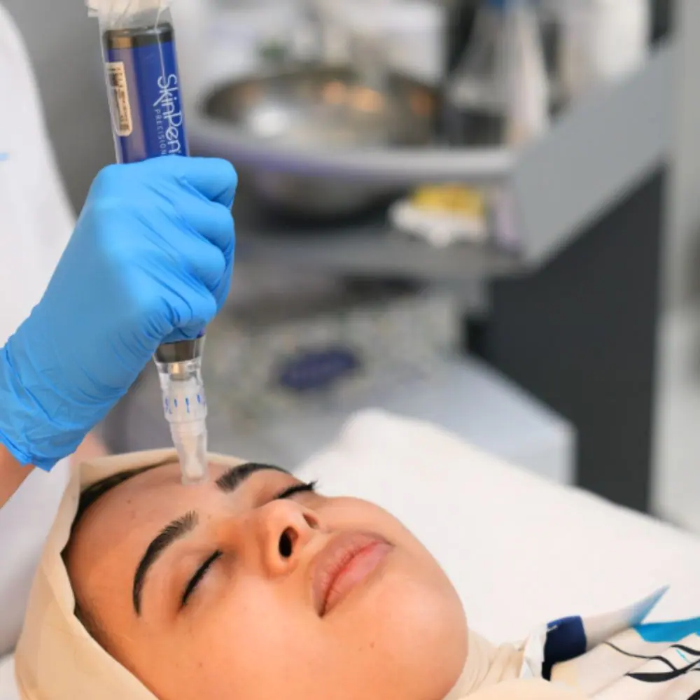 Microneedling in Kerrville and Houston, TX | Layton Aesthetic plastic surgery