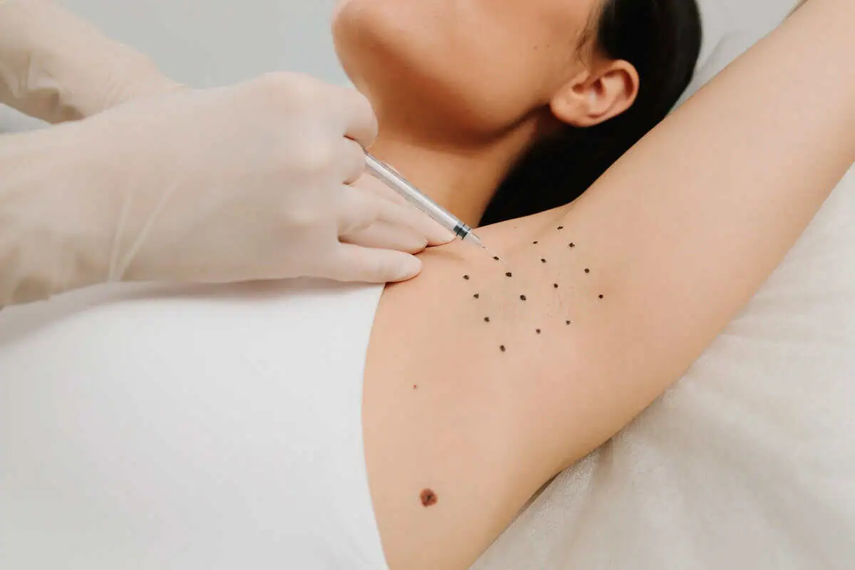 Layton Aesthetic Plastic Surgery underarm hyperhidrosis treatment in Houston, TX