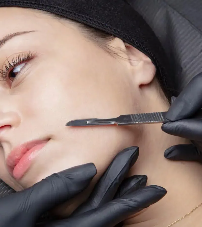 Dermaplaning in Kerrville and Houston, TX | Layton Aesthetic plastic surgery