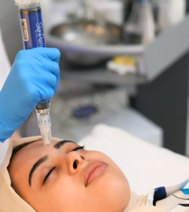 Microneedling in Kerrville and Houston, TX | Layton Aesthetic plastic surgery