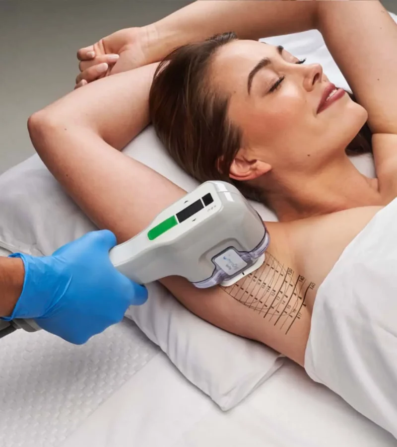 MiraDry® in Kerrville and Houston, TX MiraDry® in Kerrville and Houston, TX | Layton Aesthetic plastic surgery