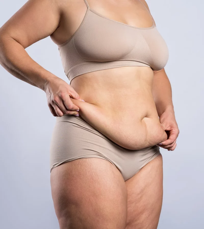 Tummy in Kerrville and Houston, TX at Layton Aesthetic plastic surgery